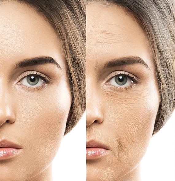 تاثیر میکرونیدلینگ بر جوانسازی پوست صورت